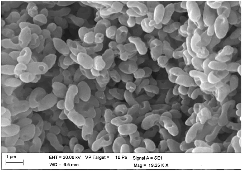 Rhodobacter sphaeroides
